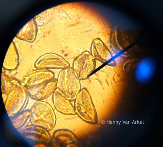 How to Prepare a Microscope Slide of Marijuana Pollen: Step-by-Step ...